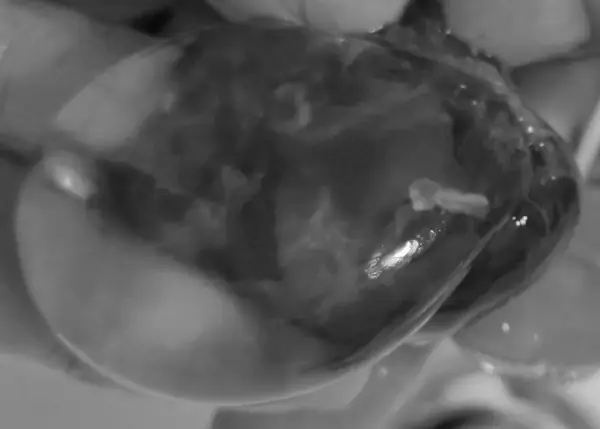 stille Geburt, Embryo, Fruchtblase